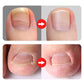 ✂️ Pedicure csipeszek
