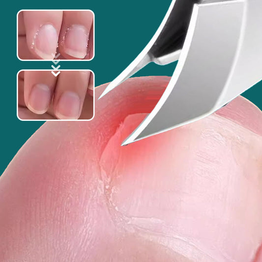 ✨【Extra ajándék】Professzionális körömvágó olló szett + INGYEN fülkefészettel! ✂️👂